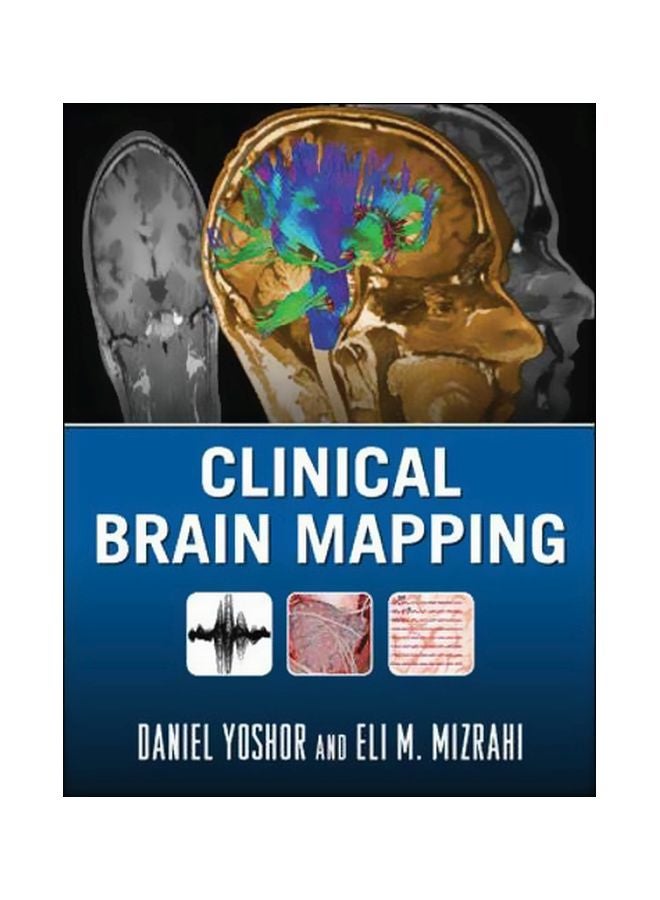 Clinical Brain Mapping hardcover english - 08 Jul 2012 