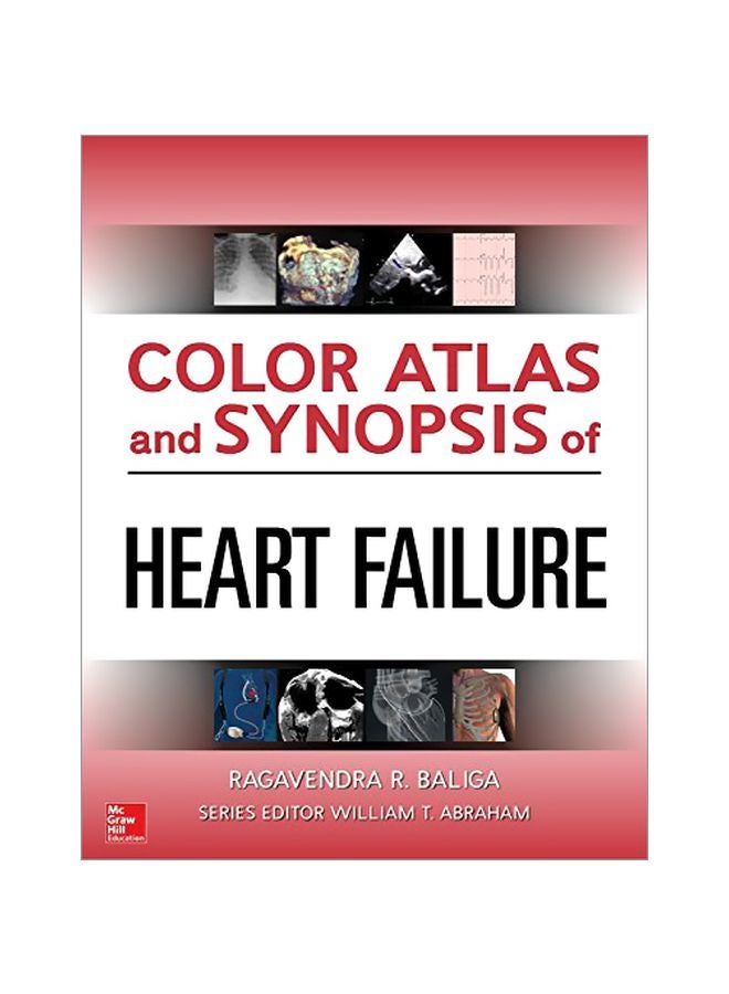 Color Atlas And Synopsis Of Heart Failure hardcover english - 25 Dec 2018 