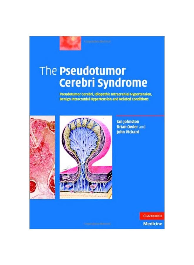 Pseudotumor Cerebri Syndrome hardcover english - 39230.0