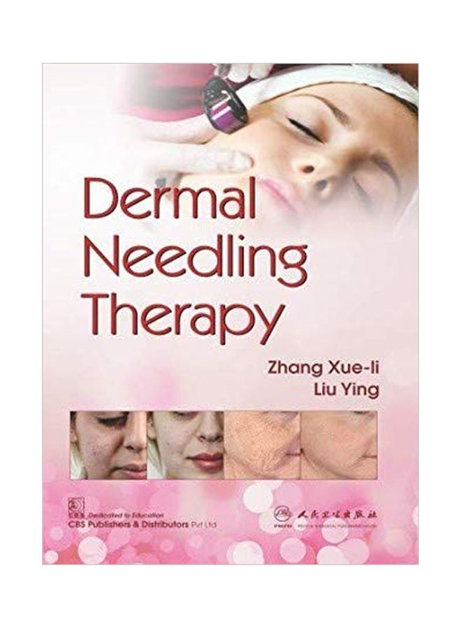 Dermal Needling Therapy paperback english