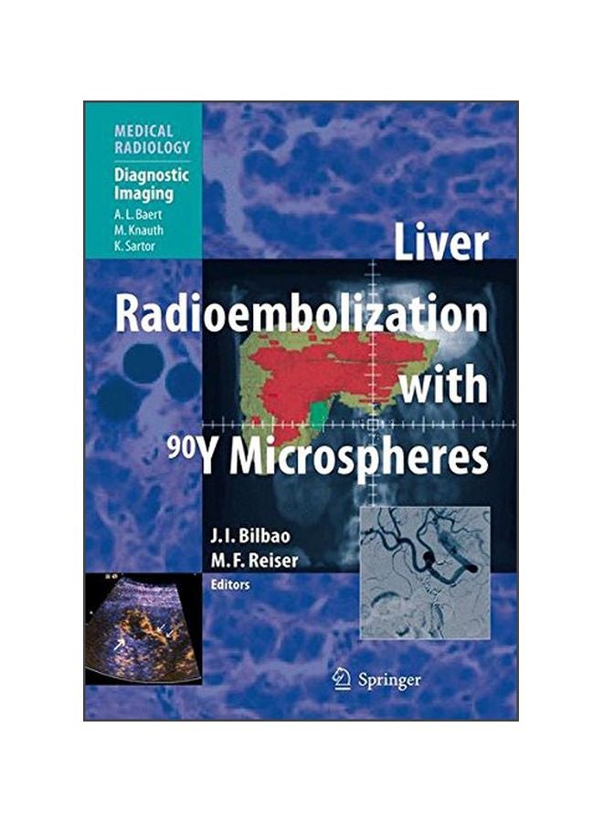 Liver Radioembolization With 90y Microspheres hardcover english - 03 Apr 2008 