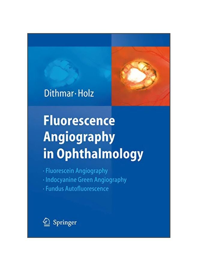 Fluorescence Angiography In Ophthalmology hardcover english - 01 Apr 2008 