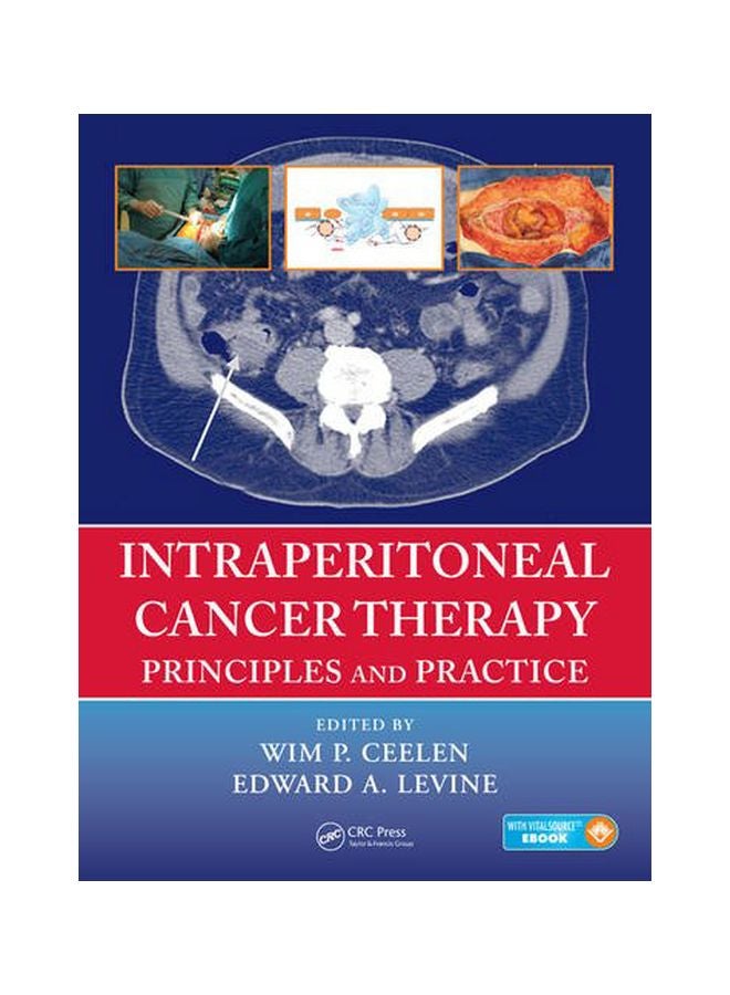 Intraperitoneal Cancer Therapy: Principles And Practice Hardcover English - 09 Dec 2015