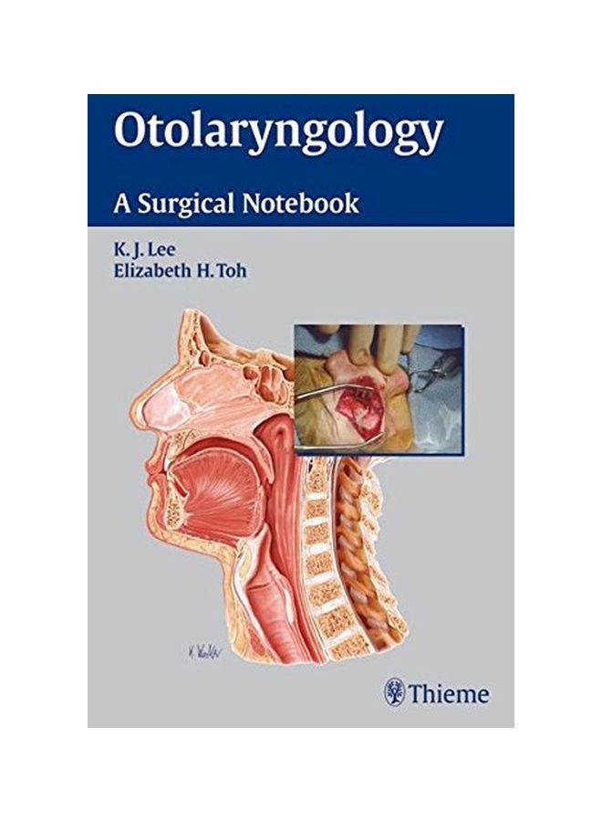 Otolaryngology : A Surgical Notebook paperback english - 01 Jul 2007 