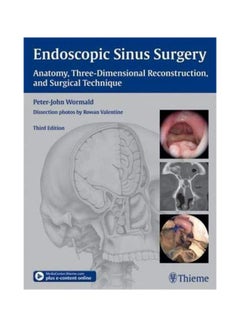Endoscopic Sinus Surgery: Anatomy, Three-dimensional Reconstruction, And Surgical Technique hardcover english - 23 Oct 2012 