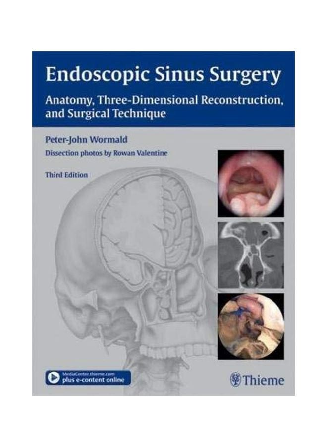 Endoscopic Sinus Surgery: Anatomy, Three-dimensional Reconstruction, And Surgical Technique hardcover english - 23 Oct 2012 