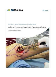 Minimally Invasive Plate Osteosynthesis hardcover english - 11 Jul 2012 
