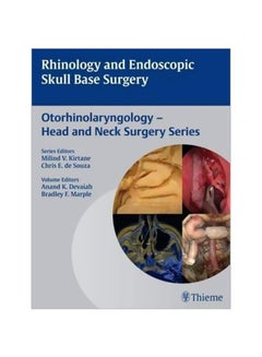 Rhinology And Endoscopic Skull Base Surgery: Otorhinolaryngology - Head And Neck Surgery Paperback English - 12 Mar 2014 