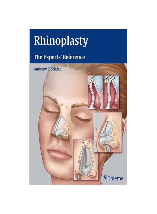 Rhinoplasty: The Experts' Reference hardcover english - 20 Apr 2015 