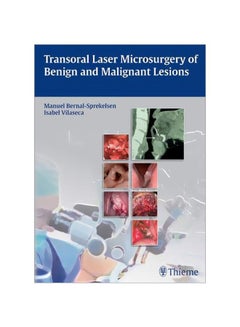 Transoral Laser Microsurgery Of Benign And Malignant Lesions hardcover english - 25 Sep 2015 