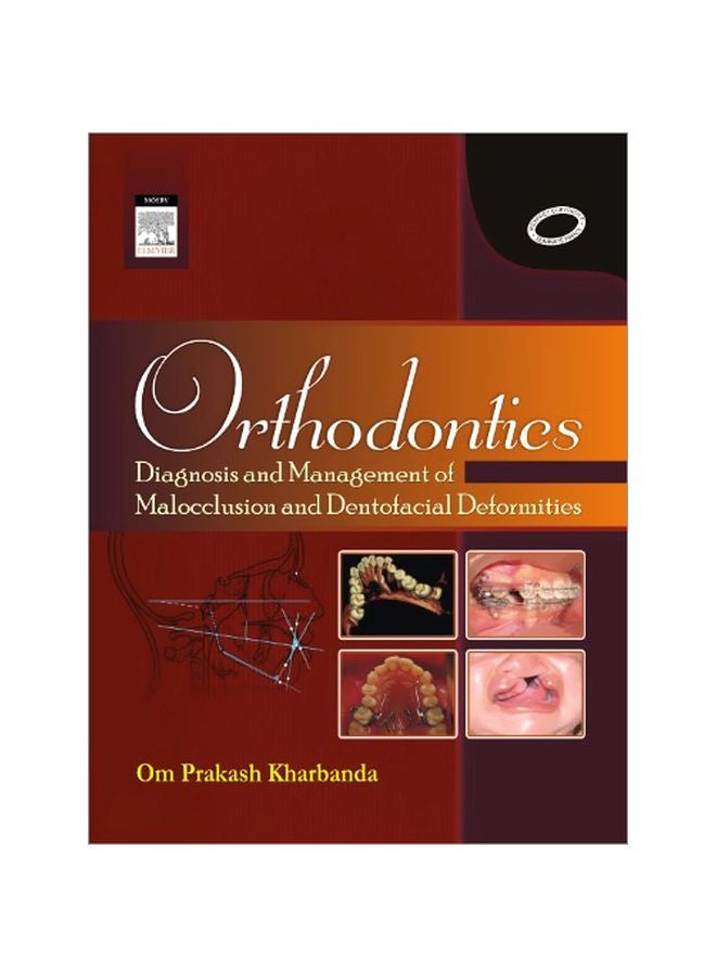 Orthodontics: Diagnosis And Manangement Paperback English by O. P. Kharbanda - 23 Nov 2009