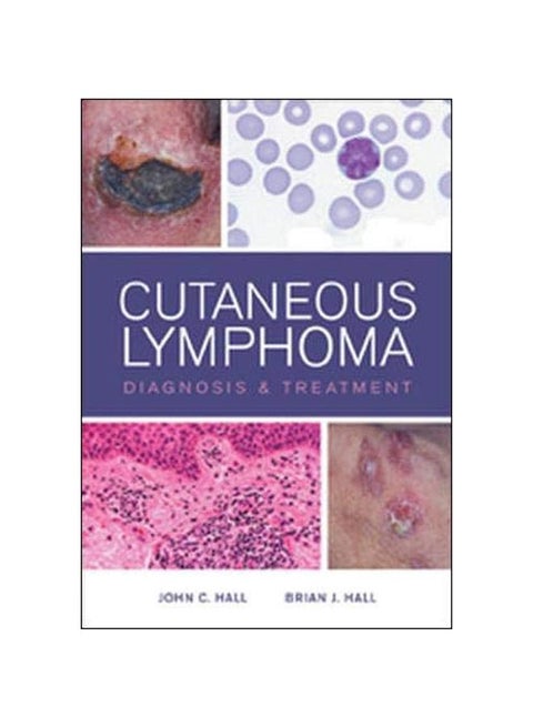 Cutaneous Lymphoma Diagnosis And Treatment Hardcover English by Brian J. Hall - 16 Aug 2012