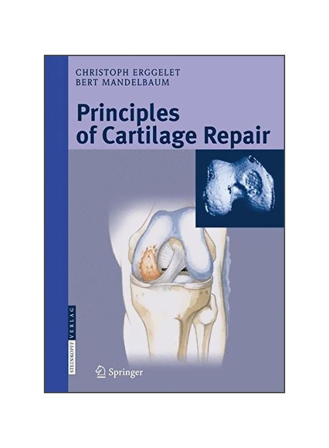 Principles Of Cartilage Repair Hardcover English by Christoph Erggelet - ?30 Oct 2008