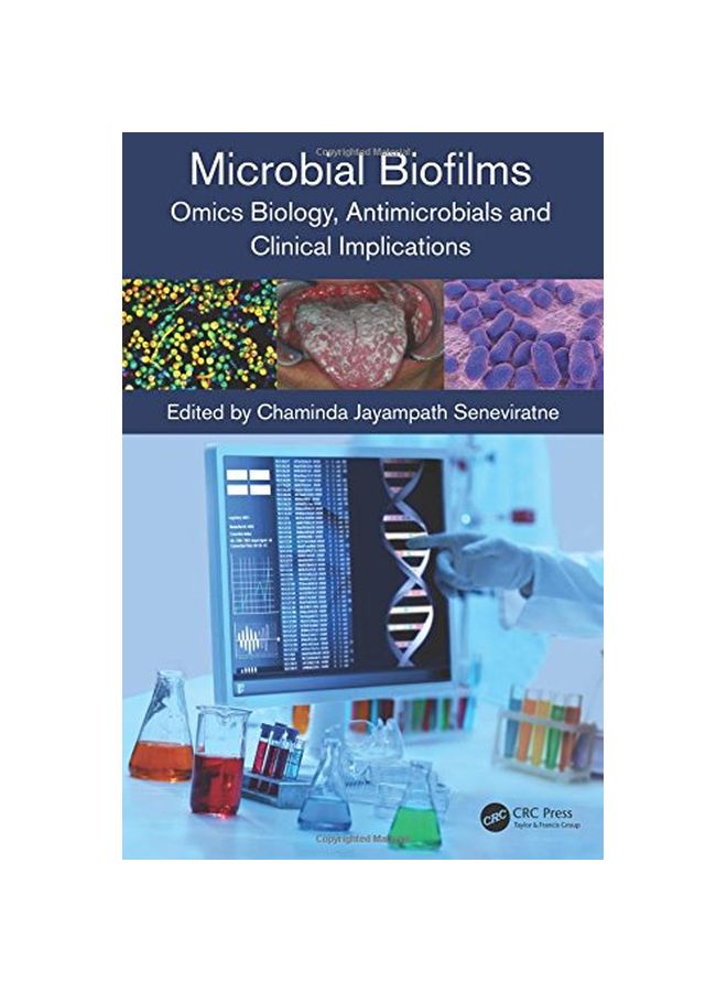 Microbial Biofilms: Omics Biology, Antimicrobials and Clinical Implications Hardcover English 