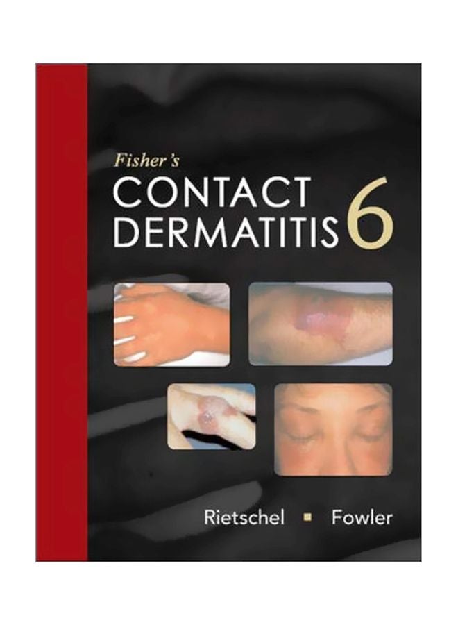 Fisher's Contact Dermatitis Hardcover English by Joseph M. Fowler - 01 Jun 2008 