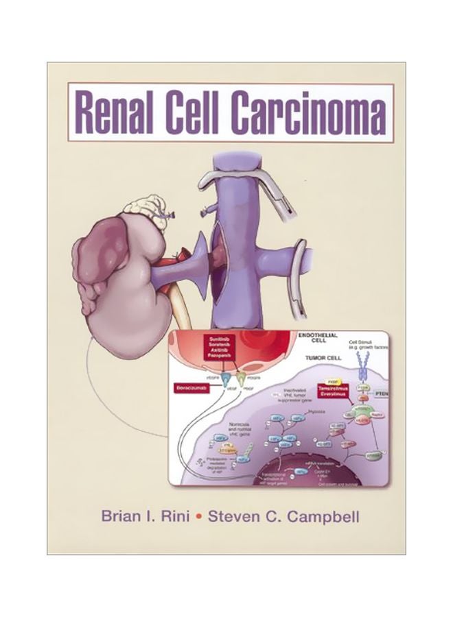 Renal Cell Carcinoma Hardcover English by Brian Rini - 01 Jun 2009 