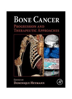 Bone Cancer: Progression And Therapeutic Approaches hardcover english - 40121.0 