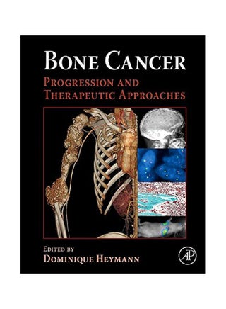 Bone Cancer: Progression And Therapeutic Approaches hardcover english - 40121.0 - v1583821670/N35523938A_1