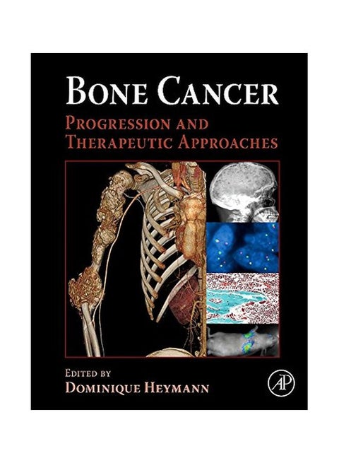 Bone Cancer: Progression And Therapeutic Approaches hardcover english - 40121.0