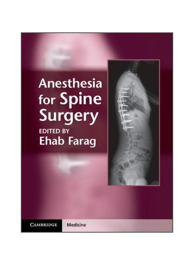 Anesthesia For Spine Surgery hardcover english - 41090.0