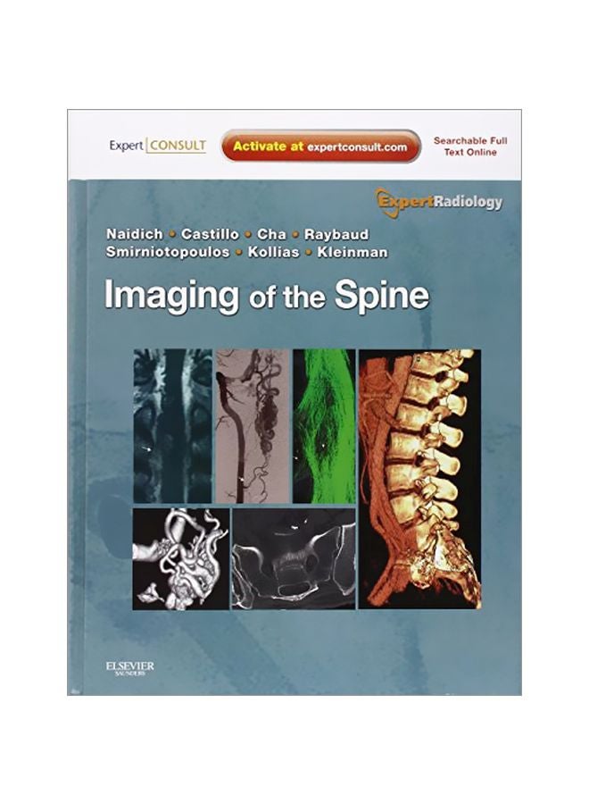 Imaging Of The Spine Hardcover English by Thomas P Naidich - 40794.0 