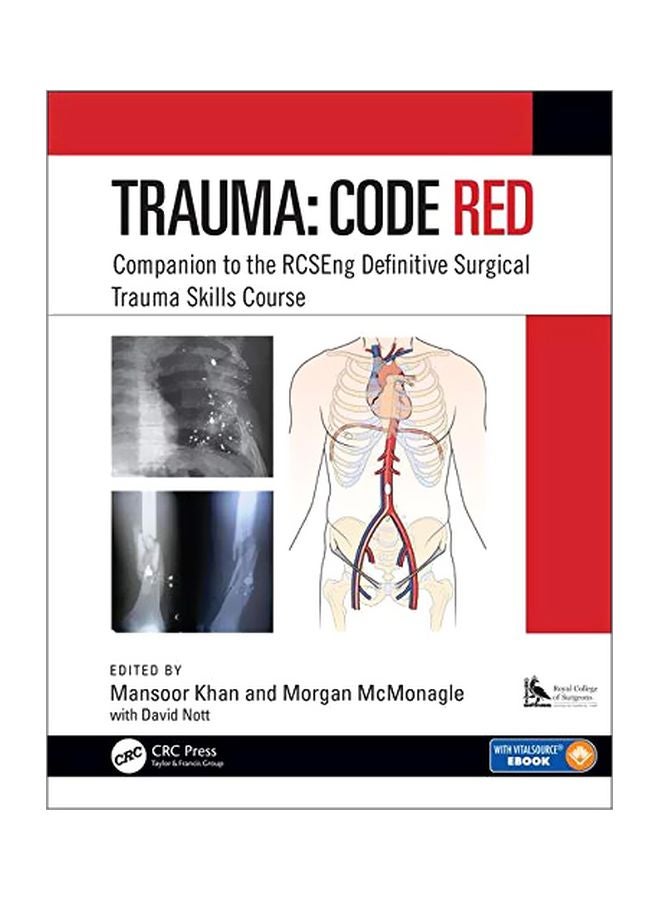 Trauma: Code Red: Companion To The RCSEng Definitive Surgical Trauma Skills Course eBook English by Mansoor Ali Khan - 43406