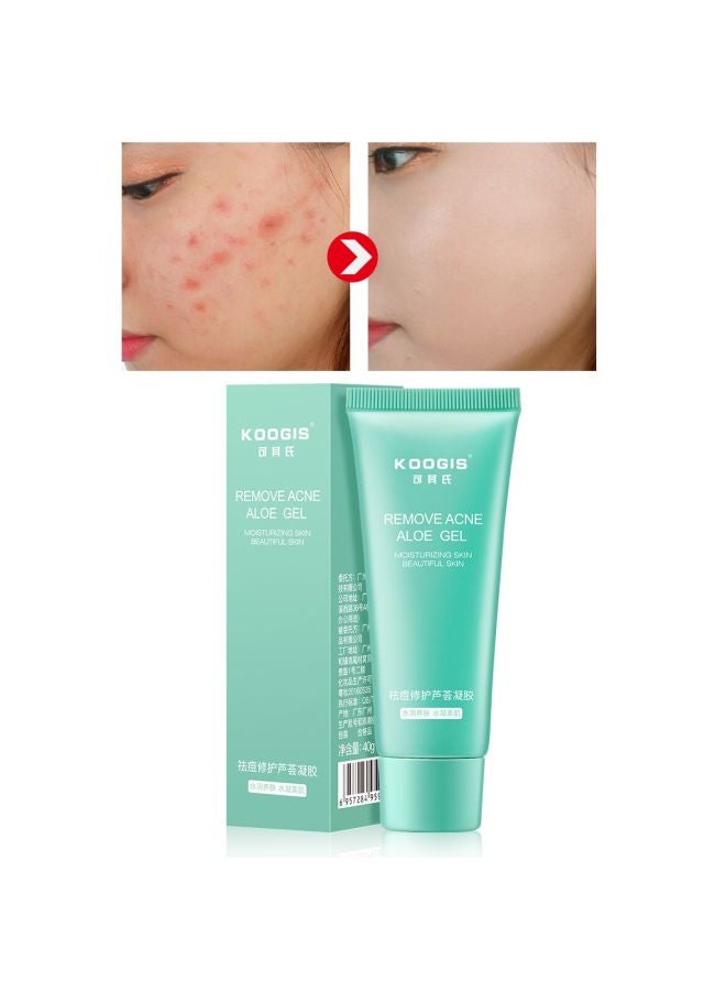 Koogis Acne Removal Aloe Vera Gel  - Image 3