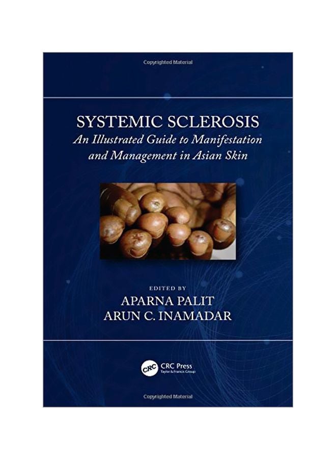 Systemic Sclerosis : An Illustrated Guide To Manifestation And Management In Asian Skin hardcover english - 02-May-19 