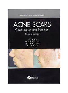 Acne Scars: Classification And Treatment Paperback English by Antonell Tosti - 43406 