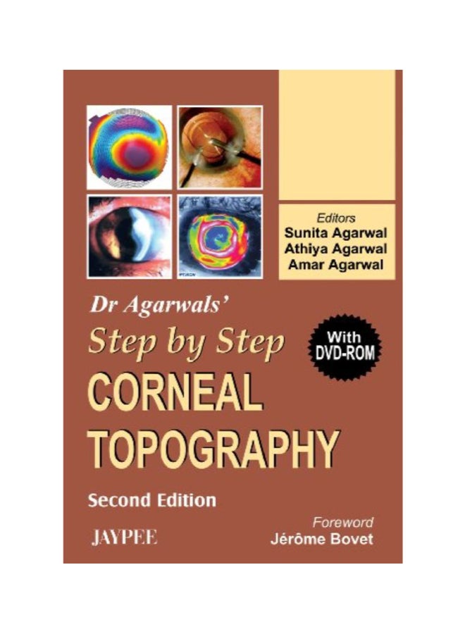 Dr Agarwal's Step by Step Corneal Topography Paperback English by Agarwal