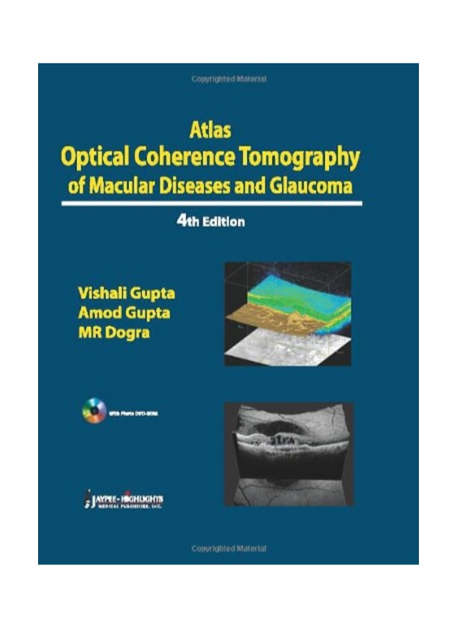 Atlas Optical Coherence Tomography Of Macular Diseases And Glaucoma paperback english - 7/1/2012