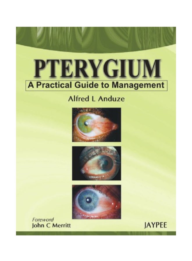 Pterygium - A Practical Guide To Management paperback english - 11/30/2009