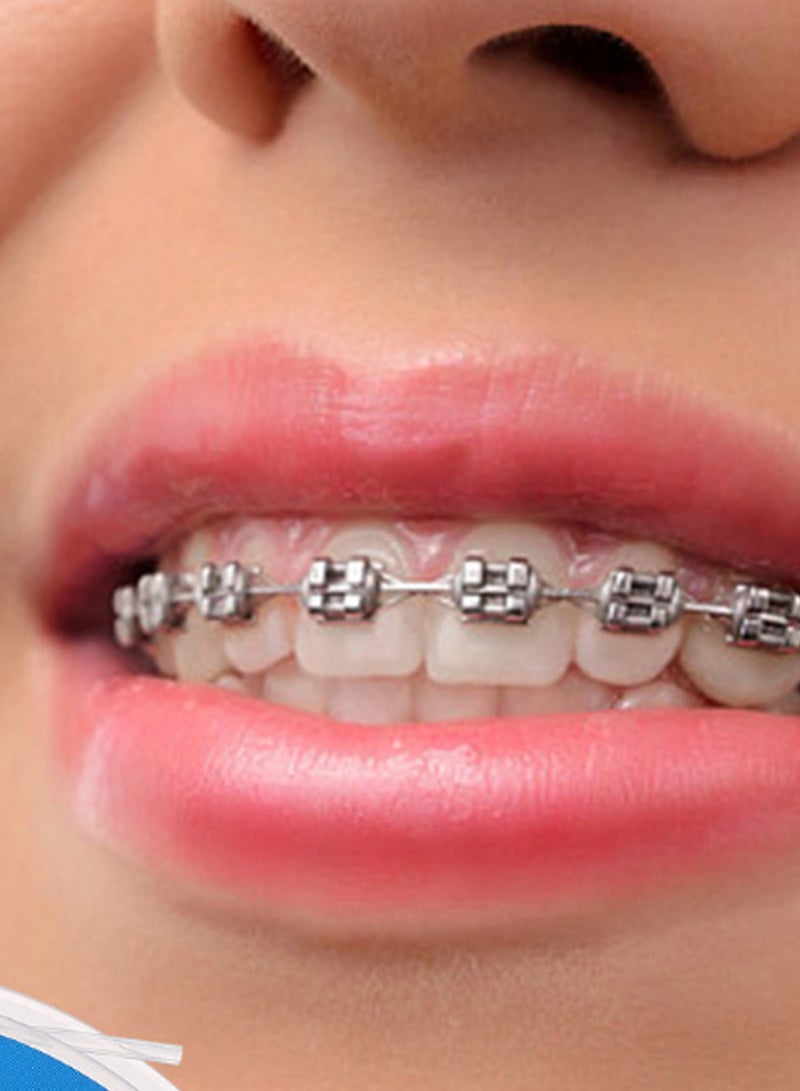Generic - Professional Orthodontic Braces Archwire Sleeve Clear 5meter - Image 1
