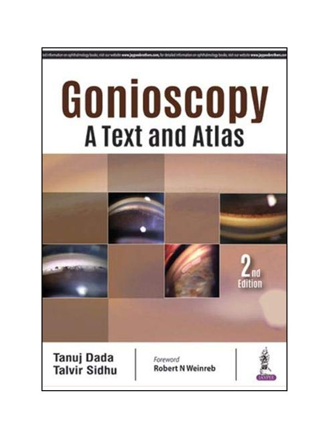 Gonioscopy A Text And Atlas hardcover english