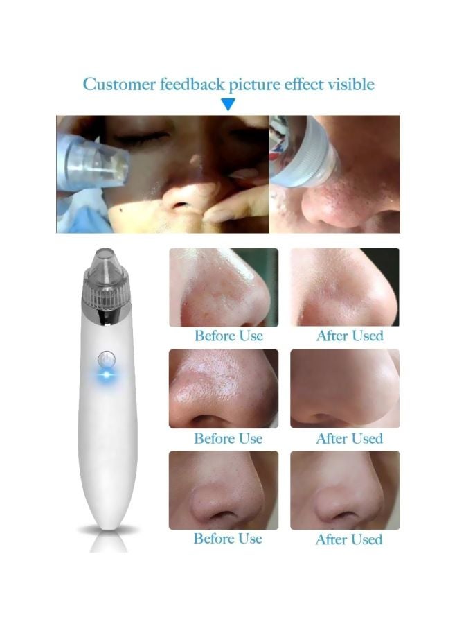 Blackhead Vacuum Cleaner White/Gold - Image 3