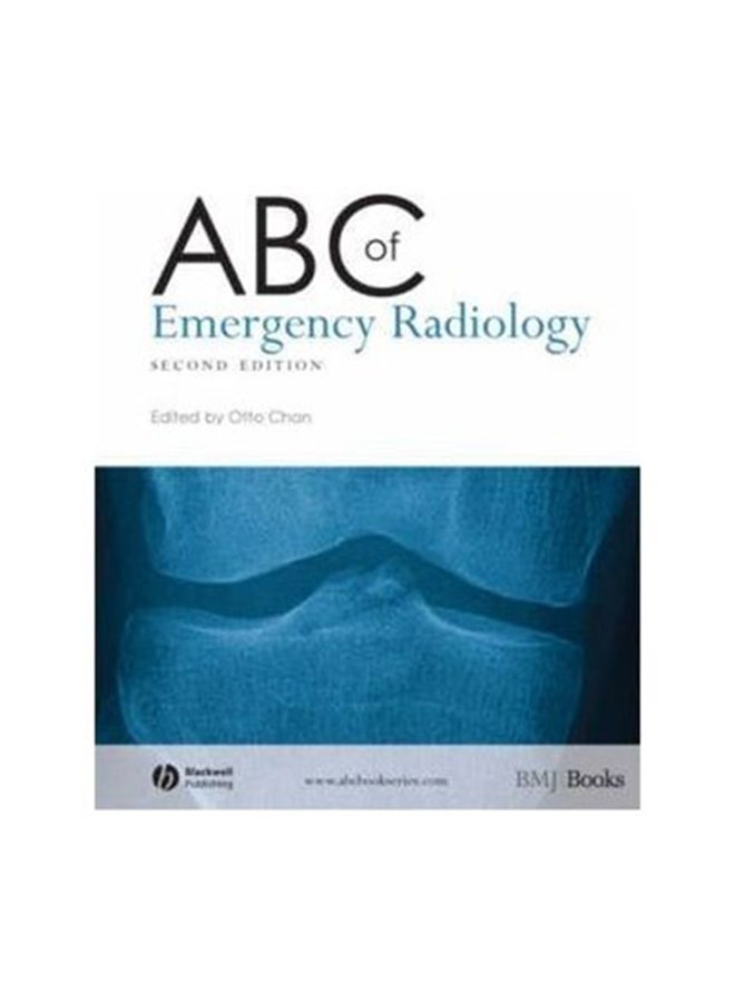 ABC Of Emergency Radiology Paperback English by Otto Chan - 39210 