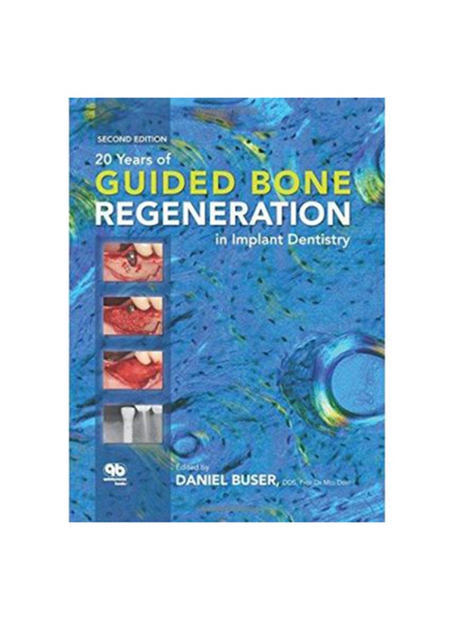 20 Years of Guided Bone Regeneration in Implant Dentistry Hardcover English by Buser, Daniel 