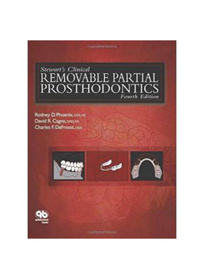 Stewart's Clinical Removable Partial Prosthodontics Hardcover English by Rodney D. Phoenix and David R. Cagna 