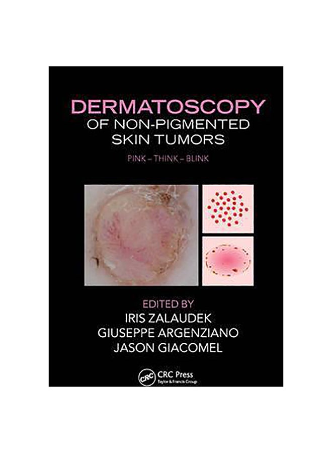 Dermatoscopy Of Non-Pigmented Skin Tumors Hardcover English by Iris Zalaudek - 7-Oct-15 