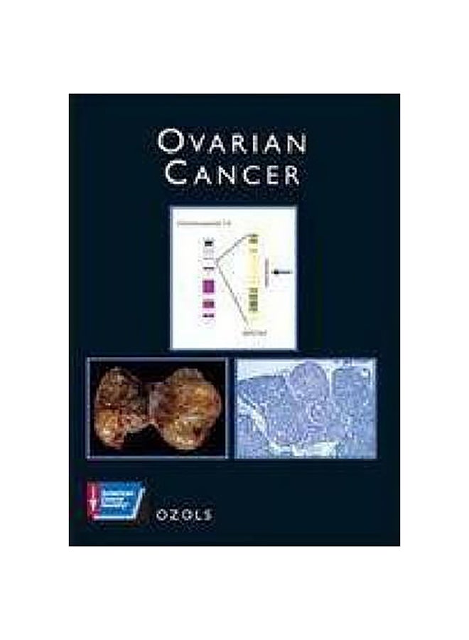 Ovarian Cancer Hardcover English by Robert Ozols - 10-Mar-03