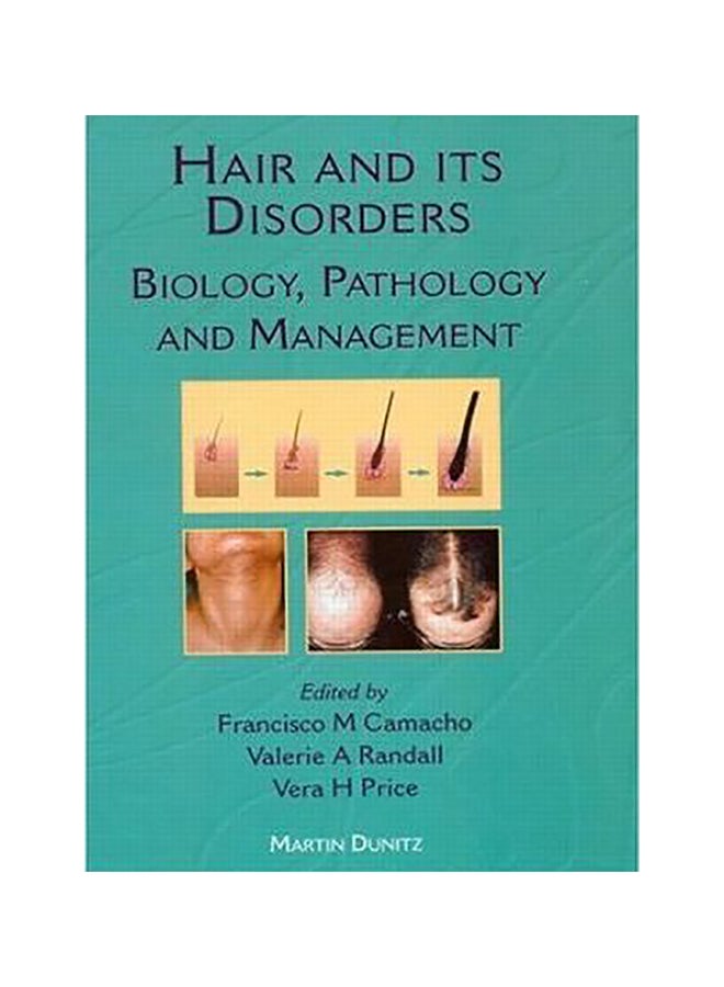 Hair And Its Disorders Hardcover English by Francisco M. Camacho - 15-Mar-00 