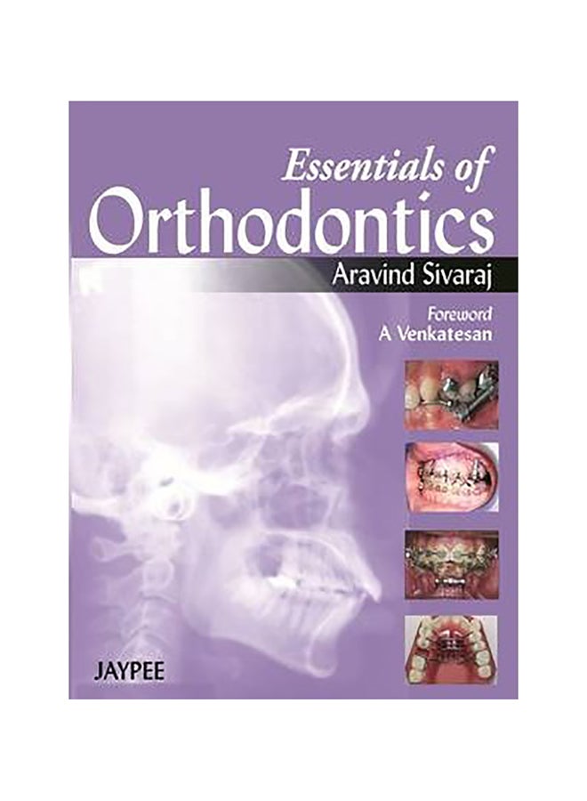 Essentials Of Orthodontics Paperback English by Aravind Sivaraj - 31-Aug-13 