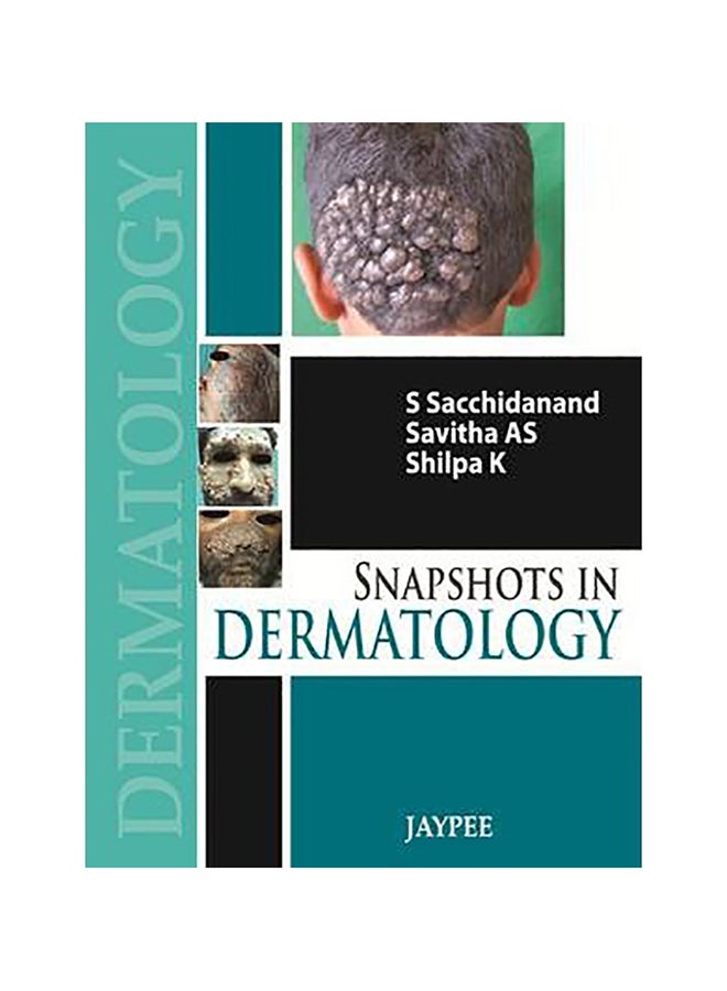 Snapshots In Dermatology Paperback English by S. Sacchidanand - 30-Jun-13 