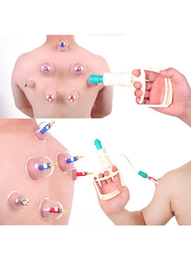 Generic - 12-Piece Body Massage Cupping Suction Therapy Device - Image 1