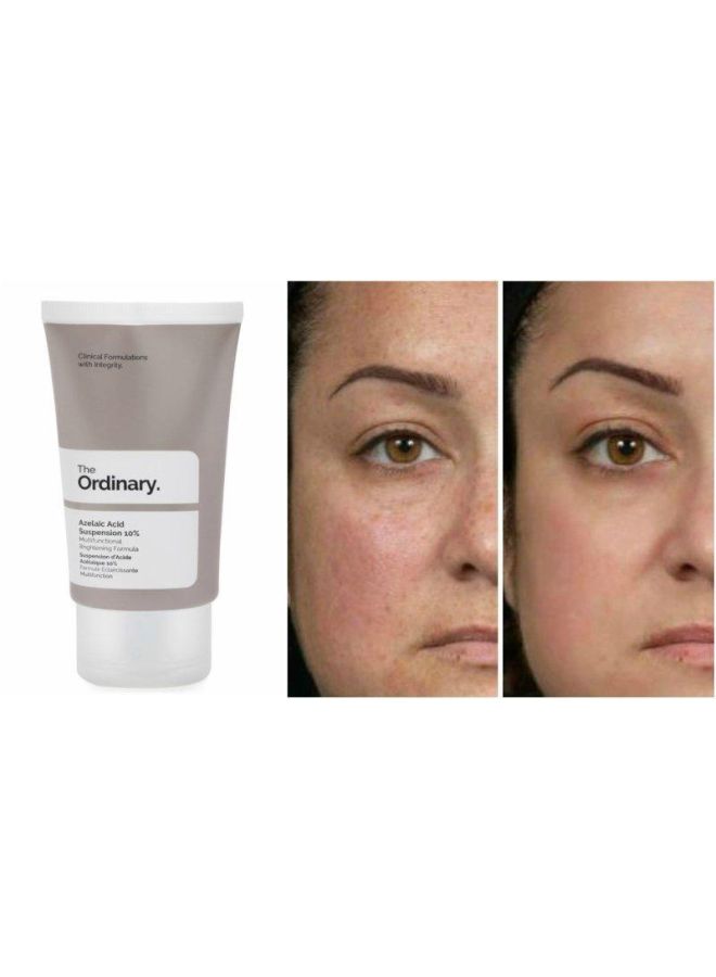 The Ordinary - Azelaic Acid Suspension 10 Percent 30ml - Image 1