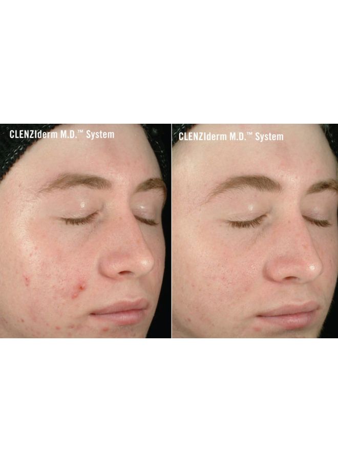 أوباجي مرطب علاجي كلينزايدرم M.D. 50ملليلتر - Image 4