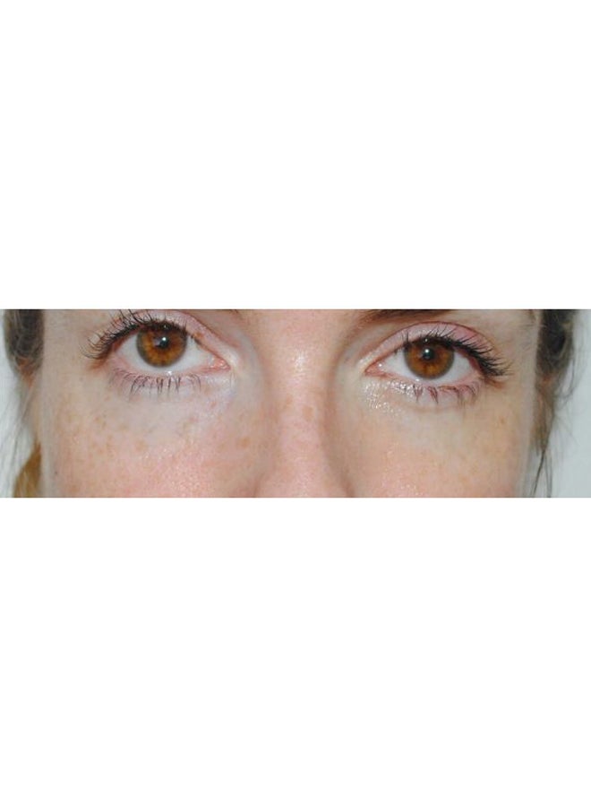 كلينيك كريم حول العينين أول أبوت آيز 15ملليلتر - Image 4