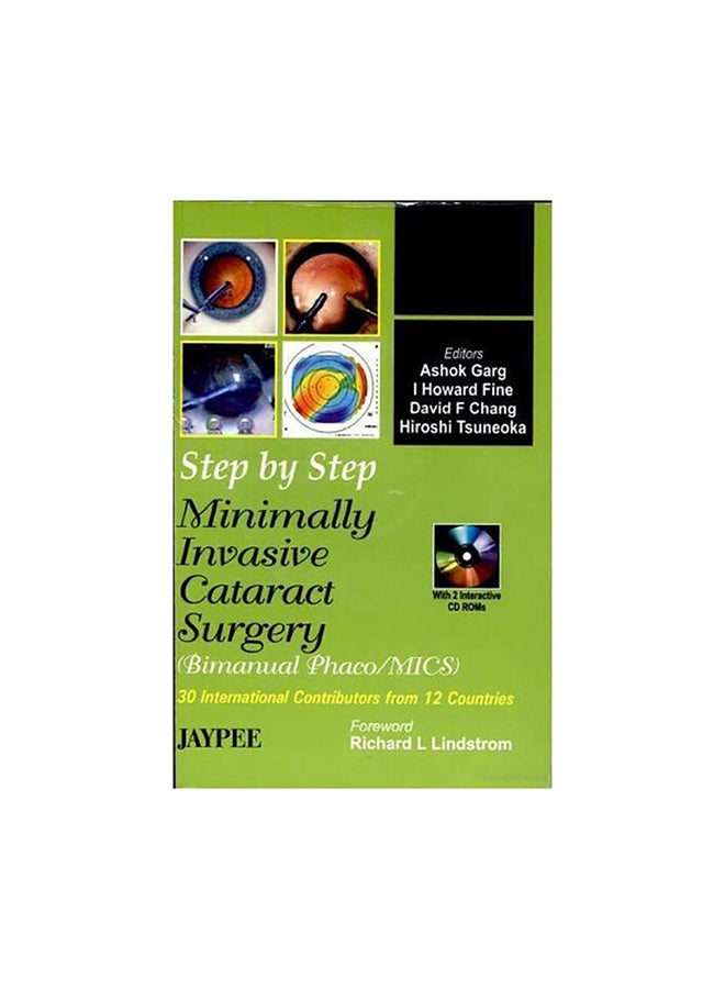 ‎Step by Step Minimally Invasive Cataract Surgery‎ Paperback English by Lin Garg - 2006
