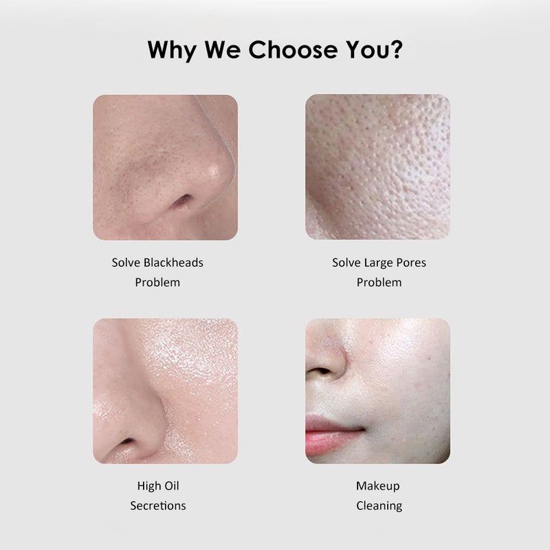 U-ltrasonic Scraper Blackheads/Pimples/Old Cutin Remove Cleanser