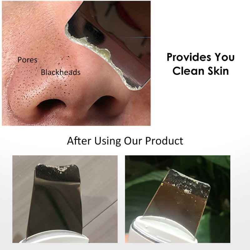 U-ltrasonic Scraper Blackheads/Pimples/Old Cutin Remove Cleanser